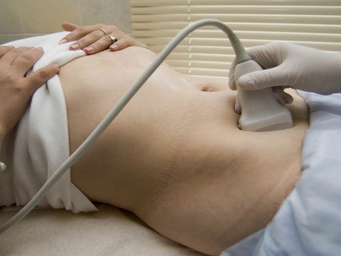 Диагноз киста яичника: лечение без операции