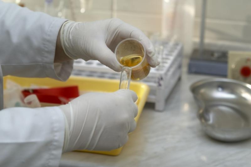 Что означает обнаружение лейкоцитов в моче?