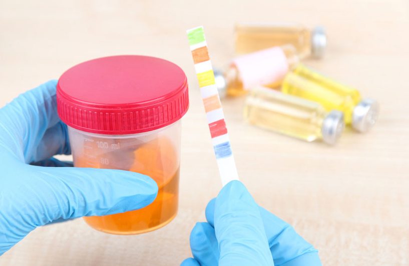 Почему моча у женщин стала ярко-желтой и что с этим делать?