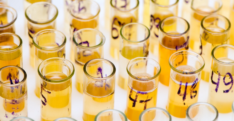 В каких случаях назначается сдача пробы Реберга?