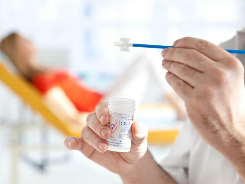 Что означает обнаружение лептотрикса в мазке?