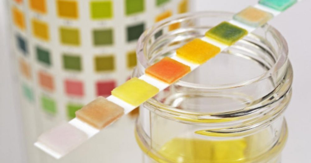 Возможные причины появления прозрачной, белой мочи у женщин