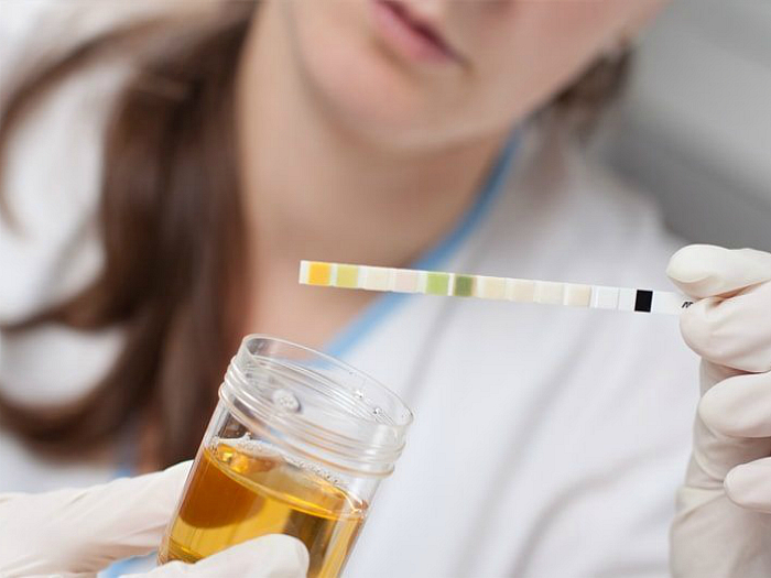 Ацетон в моче при беременности на поздних, ранних сроках