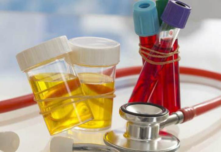 Суточная протеинурия — особенности анализа