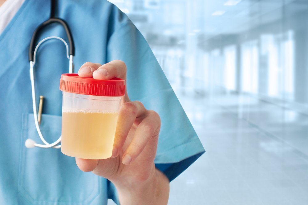 Суточный анализ мочи у беременных женщин