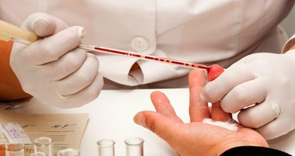 Препараты, народные средства и диета для снижения уровня мочевой кислоты в крови