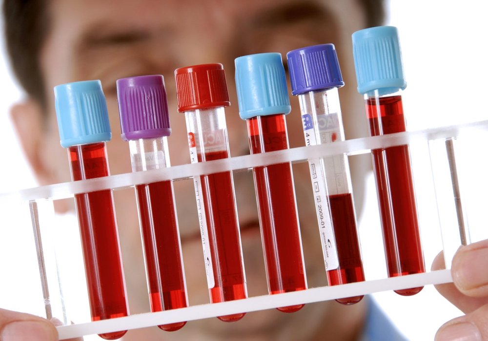 Что такое клиренс креатинина и какова норма?