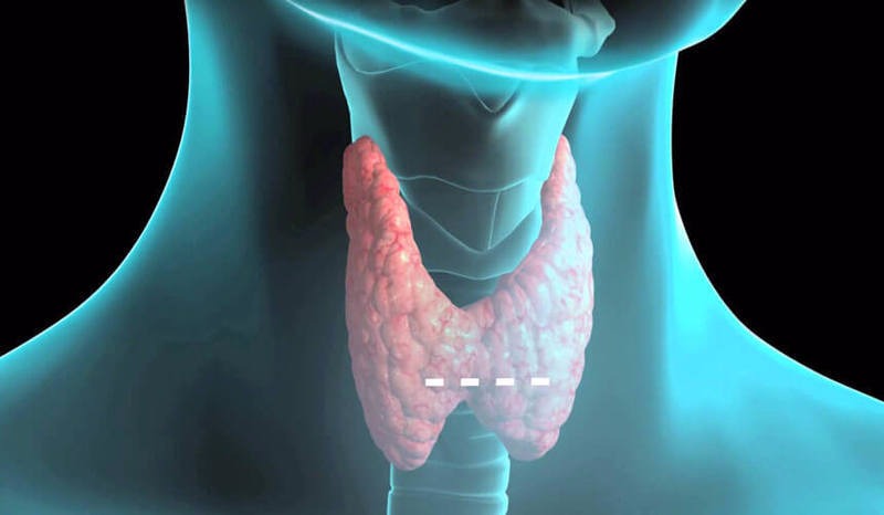 Причины и симптомы повышенного уровня гормона ТТГ у женщин