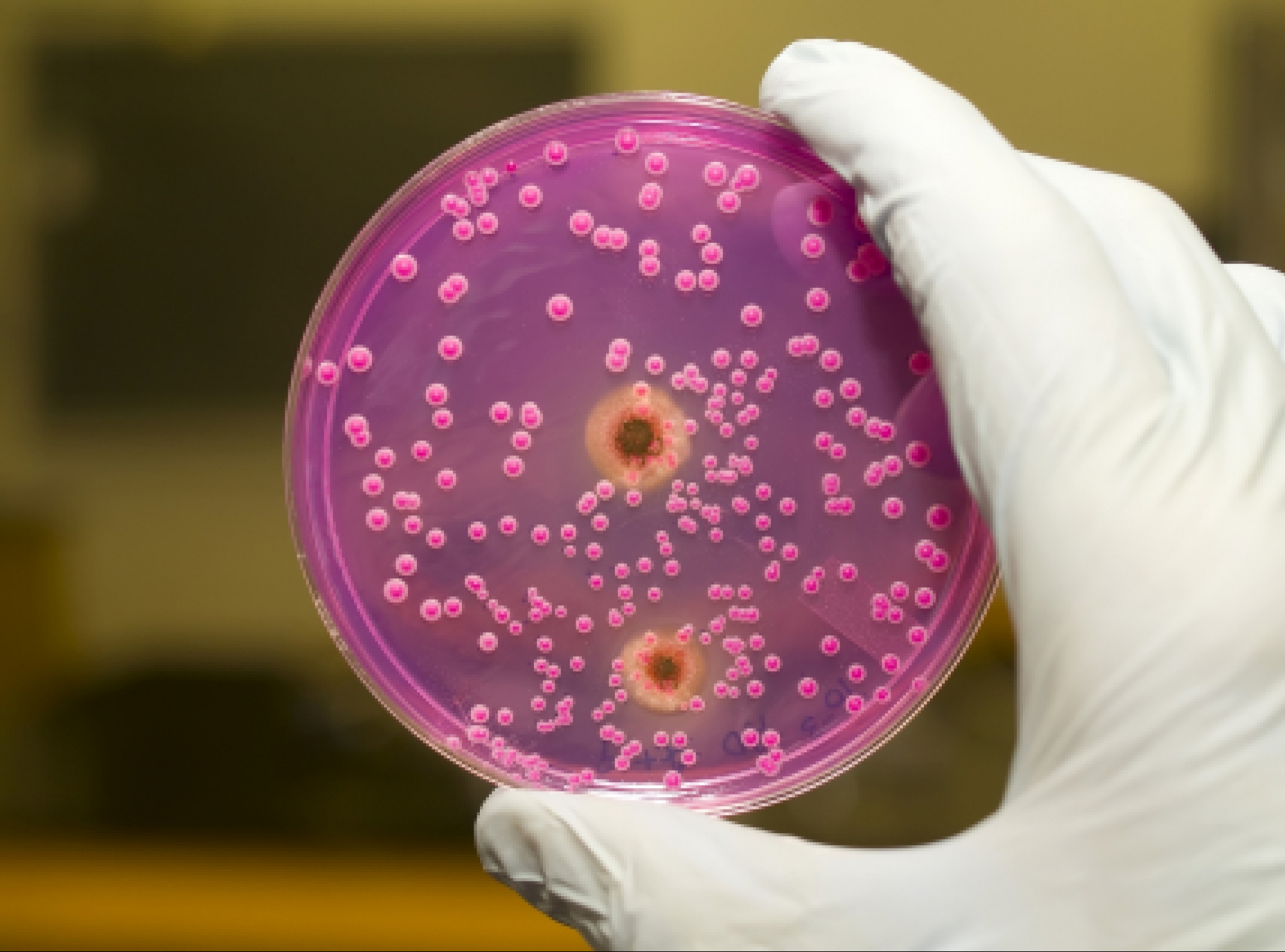 Бакпосев мочи при беременности: правила сдачи, значение и лечение