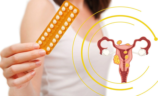 Лечение миомы матки гормональными препаратами, а также фитоэстрогенами