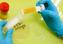 Анализ мочи в IQlab в Днепре