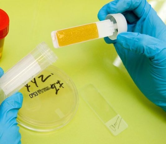 Анализ мочи в IQlab в Днепре