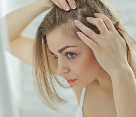 Алопеция: что это такое? Виды и причины алопеции