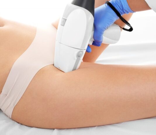 Система лазерной эпиляции — узнайте факты