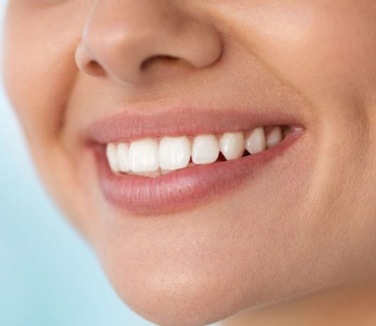 Факты о зубных имплантатах