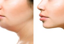 Ментопластика — кто ее делает?