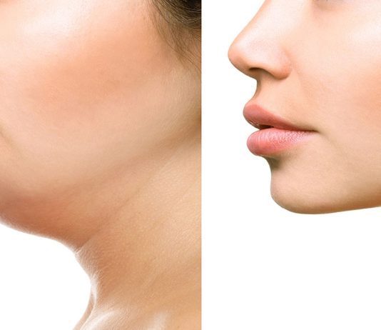 Ментопластика — кто ее делает?