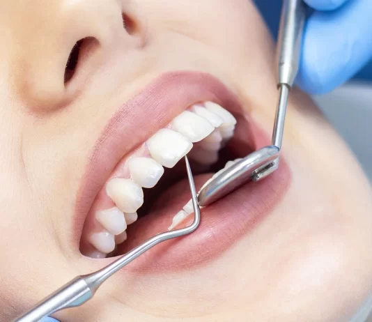 Эстетическая стоматология: преобразование улыбки с минимальным вмешательством