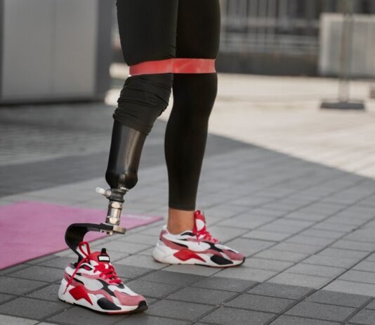 Протезы конечностей: Технологии, развитие и перспективы