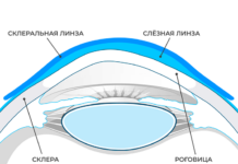 Склеральные линзы: не опасны ли такие линзы для глаз
