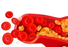 Хирургические методы лечения атеросклероза