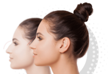 Как подготовиться к ринопластике: советы хирургов