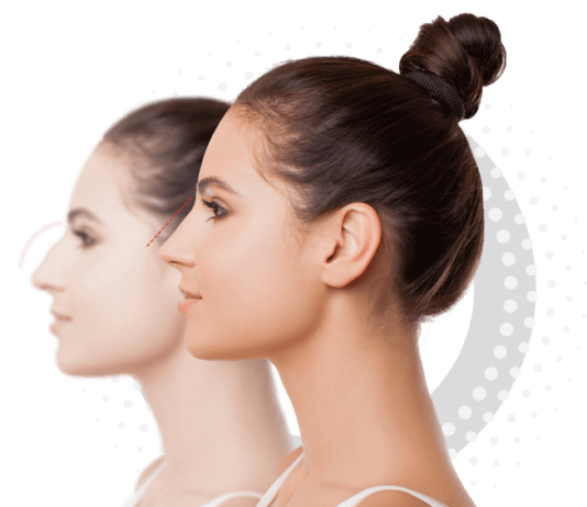 Как подготовиться к ринопластике: советы хирургов